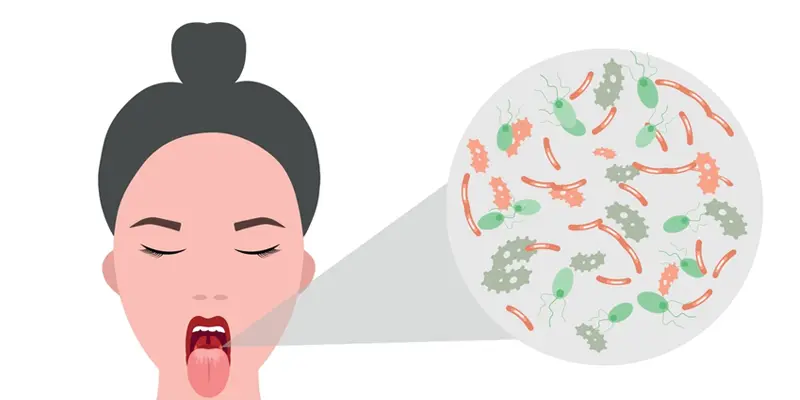 Ung thư lưỡi là một dạng ung thư vùng khoang miệng