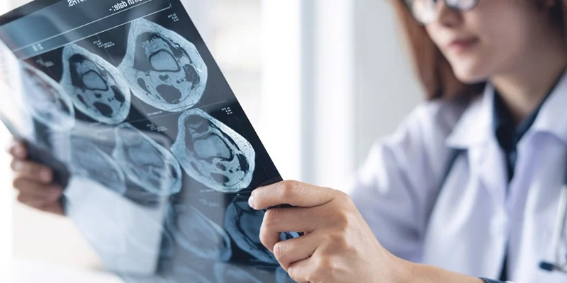 Phương pháp điều trị ung thư não dựa vào nhiều yếu tố khác nhau