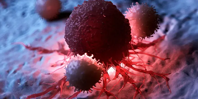 Bác sĩ sẽ chỉ định phẩu thuật để loại bỏ hoàn toàn tế bào ung thư