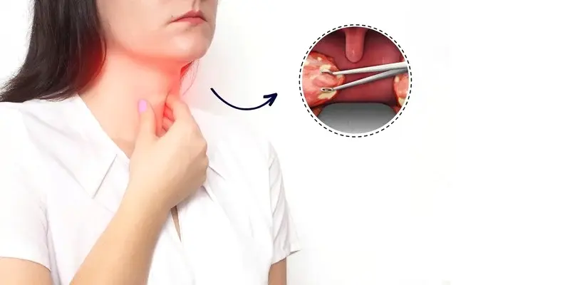 Lưu ý khi xạ trị ung thư vòm họng