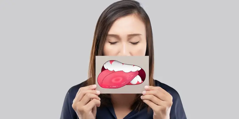 Đau lưỡi là dấu hiệu ung thư lưỡi dễ bỏ qua