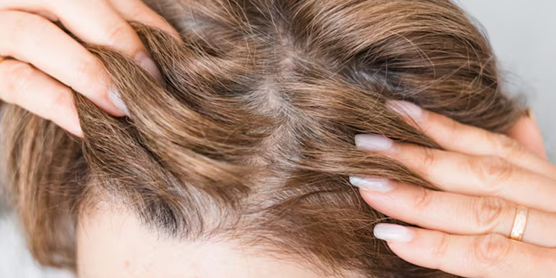 Rụng tóc là một tỏng những tác dụng phụ của xạ trị ung thư não