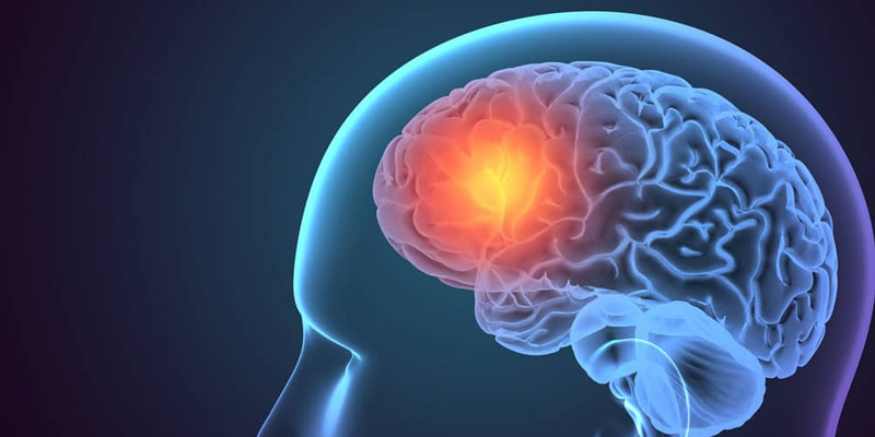 Tầm quan trọng của xét nghiệm ung thư não