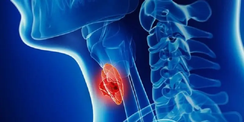 Thực hiện tầm soát sớm để kịp thời phát hiện ra bệnh