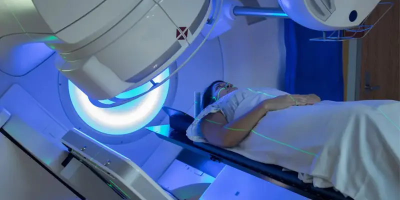 Xạ trị là một trong những phương pháp điều trị ung thư vòm họng