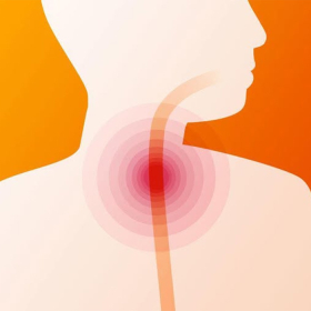 Ung thư thanh quản: Nguyên nhân, triệu chứng và cách phòng ngừa hiệu quả